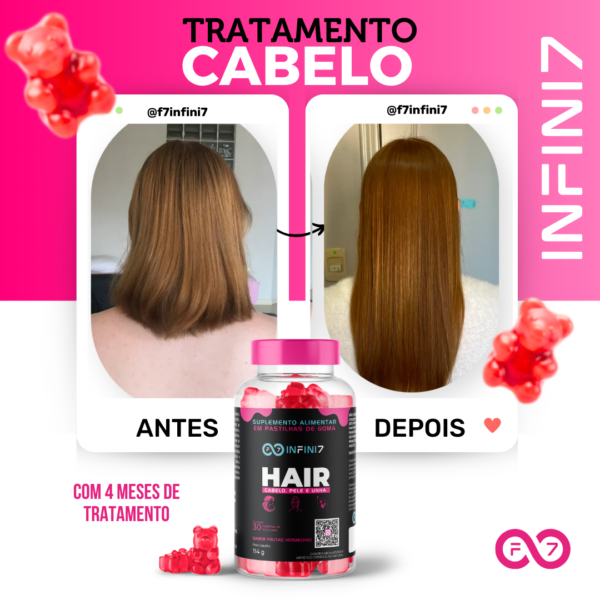 VITAMINAS EM GOMA - CABELO, PELE E UNHA