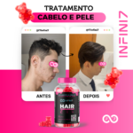 VITAMINAS EM GOMA - CABELO, PELE E UNHA